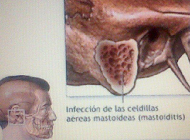 esquema de la cabeza y su relación de ubicación de la mastoides.