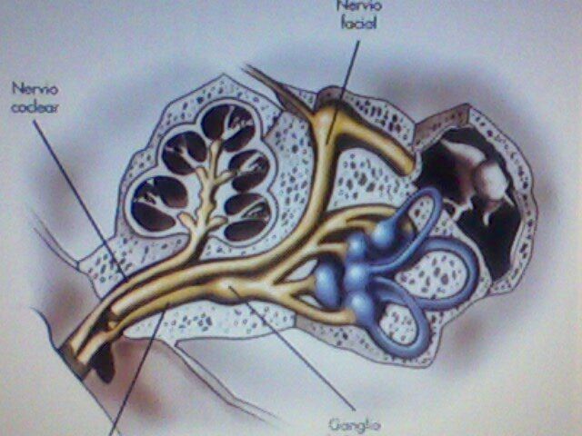 otra posición del oído interno  , en donde se observa la complejidad interna, con rampas, liquido, endolinfa, perilinfatico, neuroepitelios, especialización ,para la audición y el equilibrio, tanto en su porcino coclear, y vestibular.